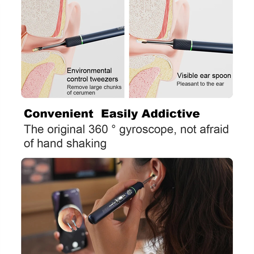 Ear Cleaner | Smart Ear Wax Removal Tool